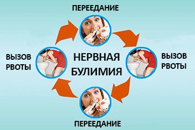Лечение булимии в Чернушк